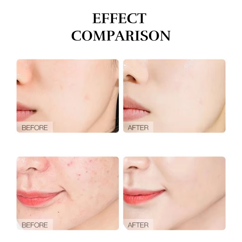Clinical Effect Comparison: Spot Fading & Radiant Clarity